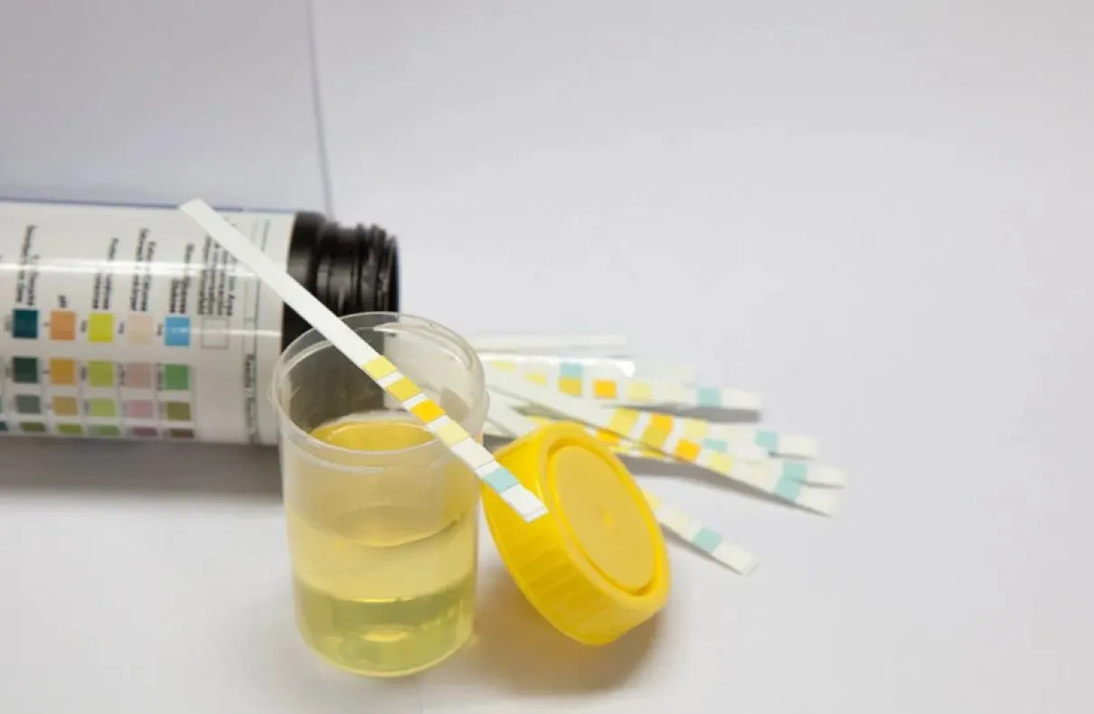 Scientists Explain Why Urine Is Yellow