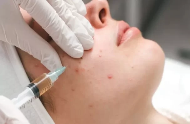 Three Women Infected With Hiv Following Unsanitary 'vampire Facials'
