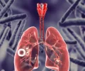 Deadly Tuberculosis Outbreak Hits California
